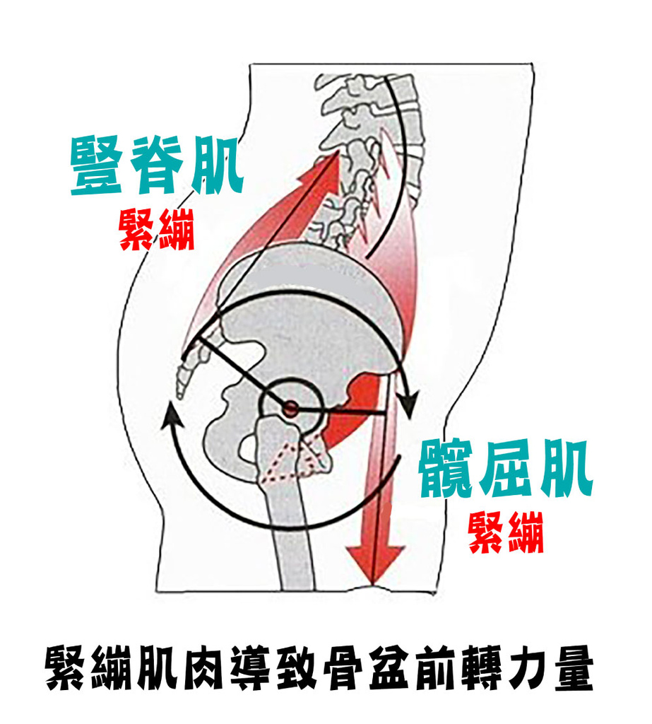 睡覺腰痛_圖9.jpg