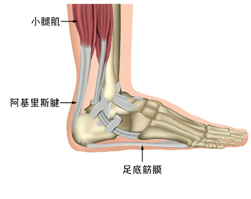 足底筋膜炎_圖5.jpg