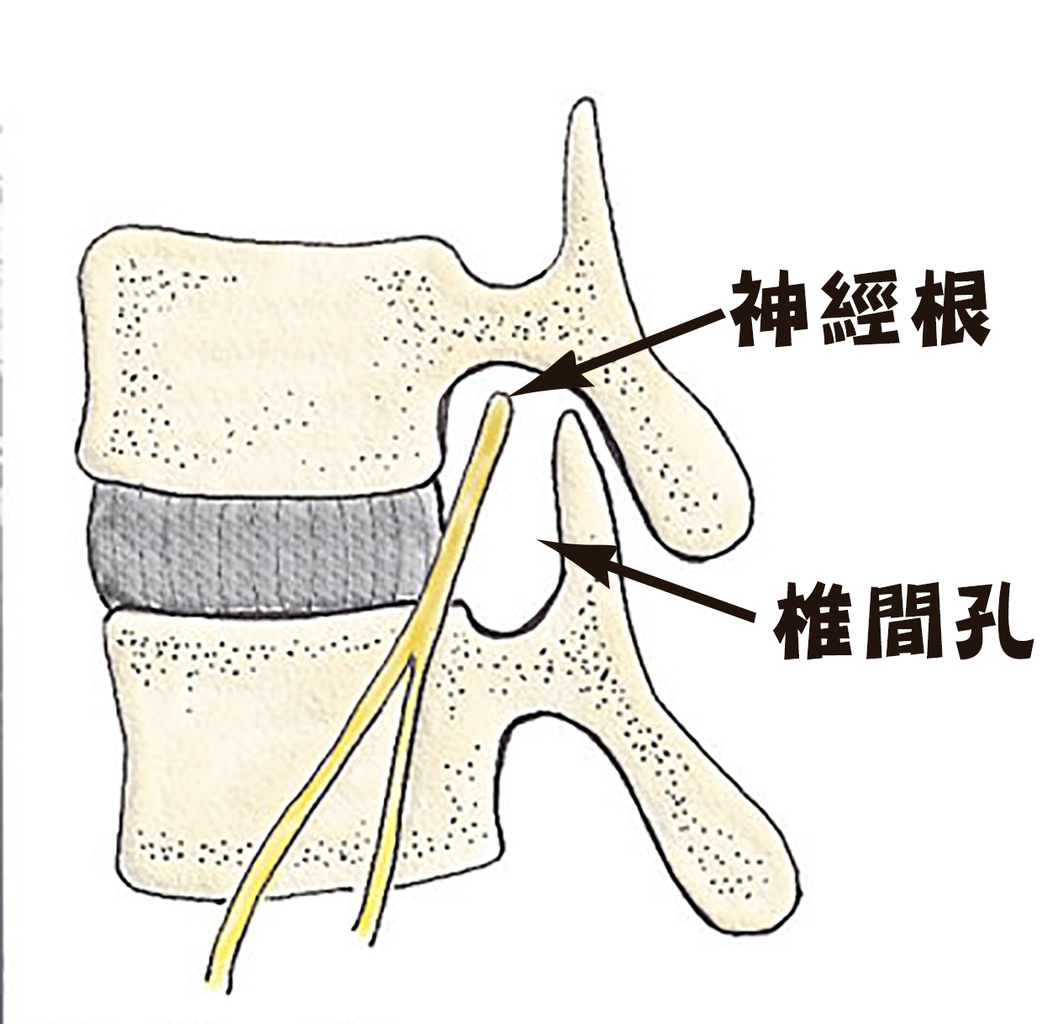 骨刺_圖21.jpg