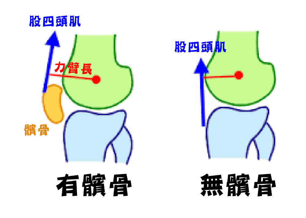 髕骨外翻_圖6.jpg